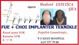 ANKARA SAÇ EKİM HAİR İMPLANTER